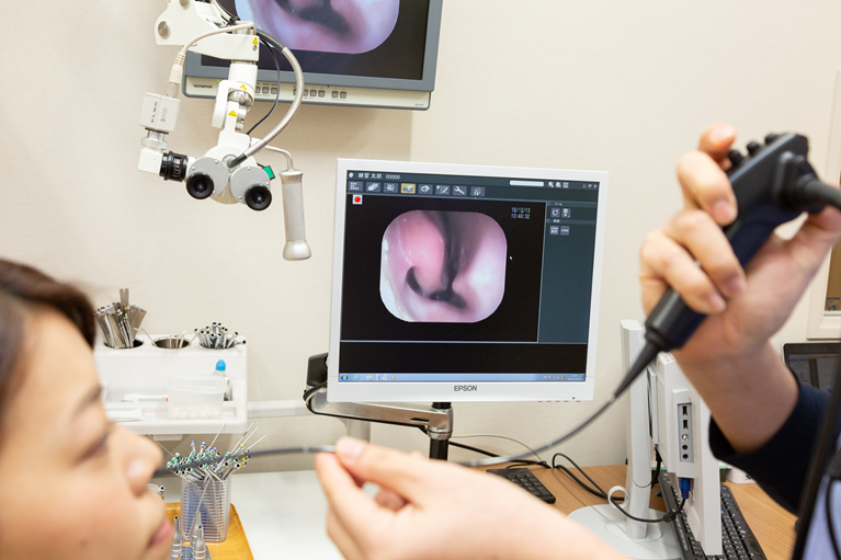 鼻・喉の内視鏡