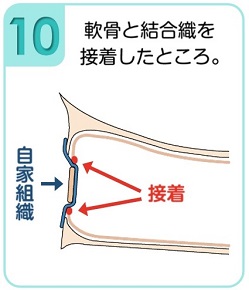 軟骨と結合織を接着したところ。