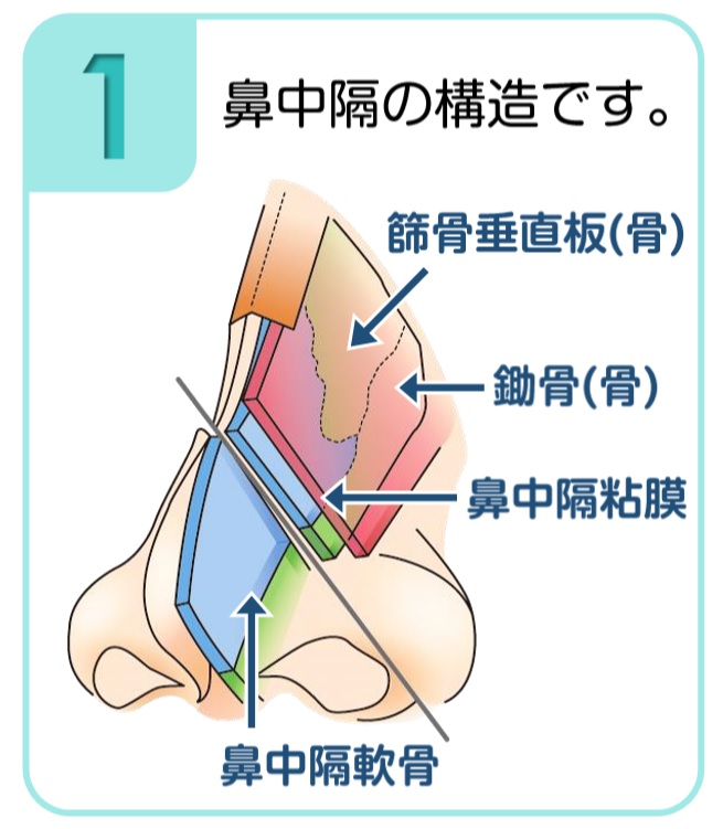 鼻中隔 押す と 痛い