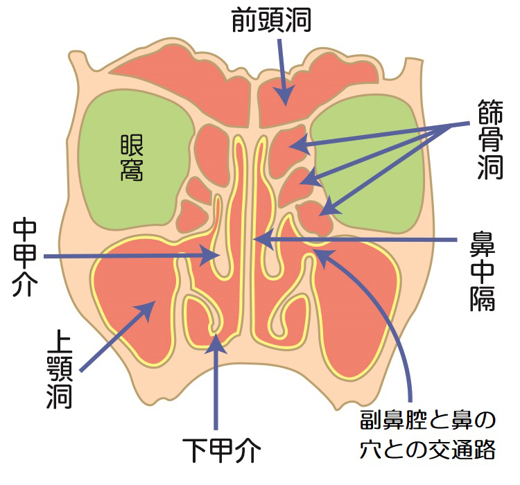 慢性 副 鼻腔 炎